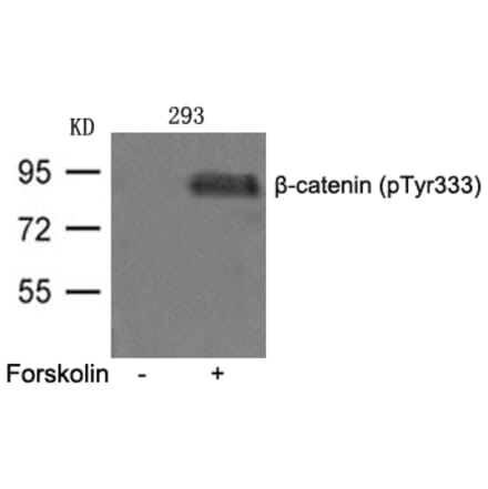 Western blot - β-catenin (phospho-Tyr333) Antibody from Signalway Antibody (11574) - Antibodies.com