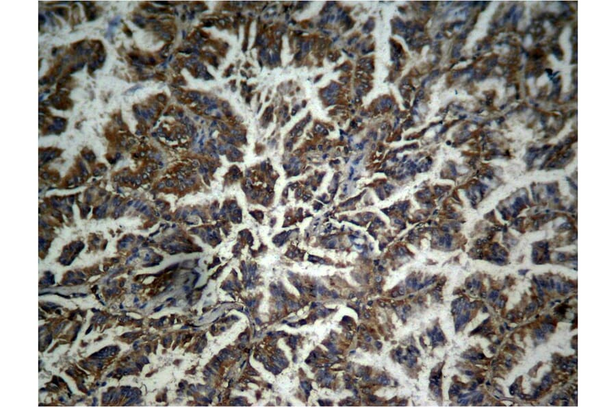 Immunohistochemistry - β-catenin (phospho-Tyr333) Antibody from Signalway Antibody (11574) - Antibodies.com