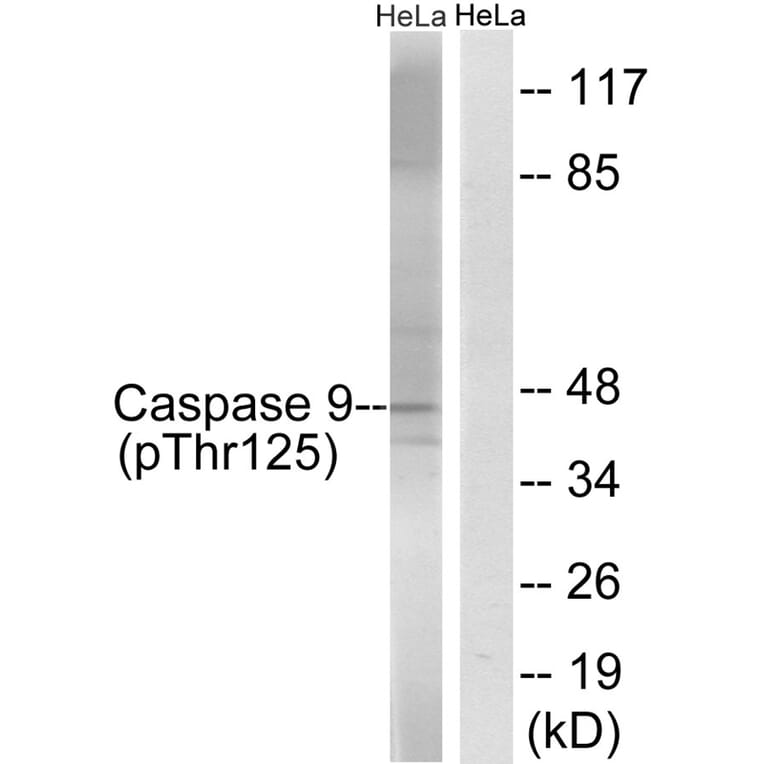 Western blot - Caspase 9 (Phospho-Thr125) Antibody from Signalway Antibody (11649) - Antibodies.com