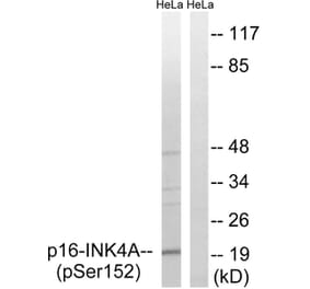 Western blot - p16-INK4a (Phospho-Ser152) Antibody from Signalway Antibody (12148) - Antibodies.com