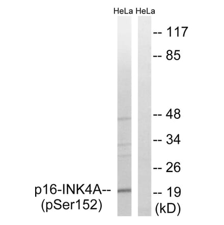 Western blot - p16-INK4a (Phospho-Ser152) Antibody from Signalway Antibody (12148) - Antibodies.com