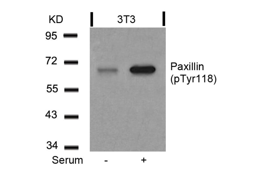 Western blot - Paxillin (Phospho-Tyr118) Antibody from Signalway Antibody (11089) - Antibodies.com