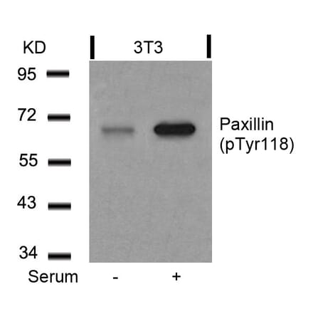 Western blot - Paxillin (Phospho-Tyr118) Antibody from Signalway Antibody (11089) - Antibodies.com
