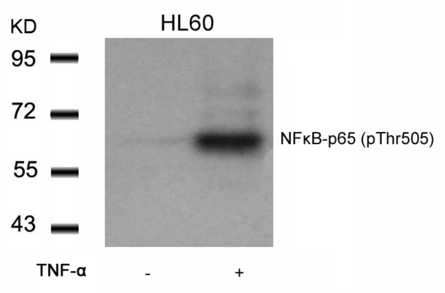 Western blot - NFkB-p65 (Phospho-Thr505) Antibody from Signalway Antibody (11166) - Antibodies.com