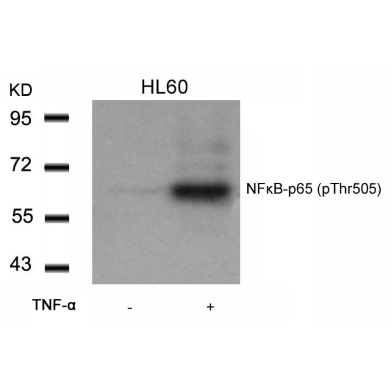 Western blot - NFkB-p65 (Phospho-Thr505) Antibody from Signalway Antibody (11166) - Antibodies.com