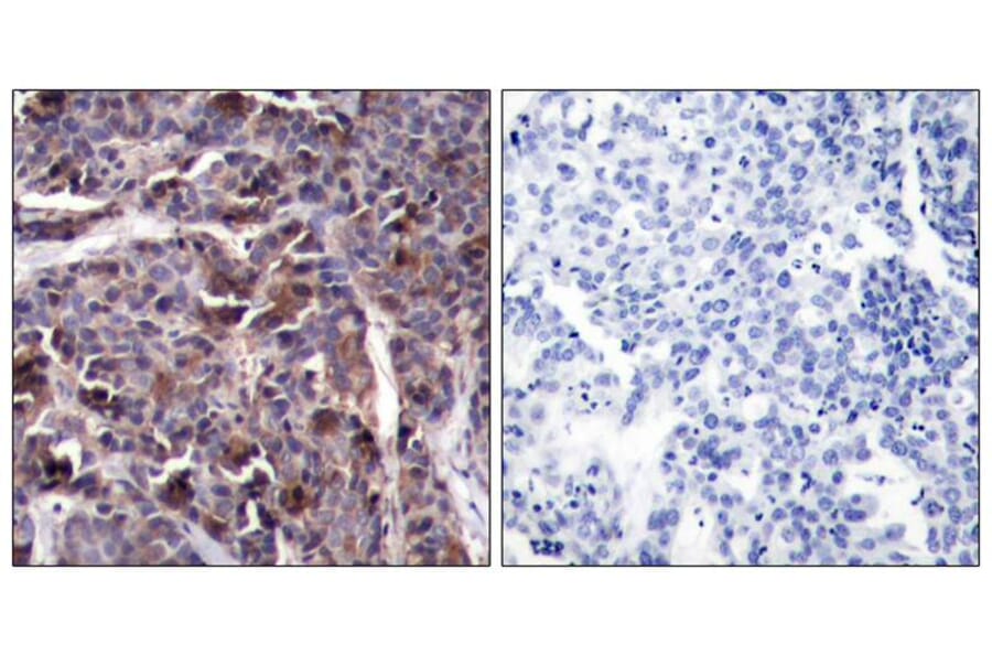 Immunohistochemistry - NFkB-p65 (Phospho-Thr505) Antibody from Signalway Antibody (11166) - Antibodies.com