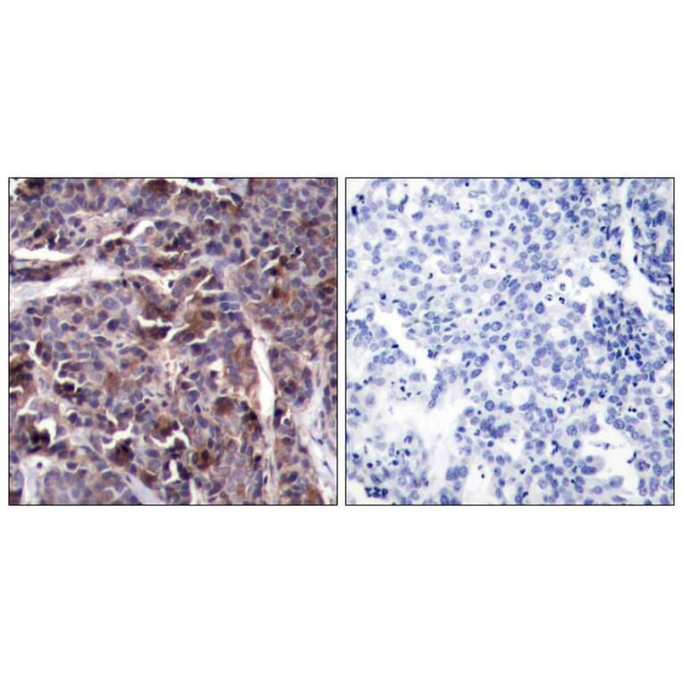 Immunohistochemistry - NFkB-p65 (Phospho-Thr505) Antibody from Signalway Antibody (11166) - Antibodies.com