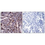 Immunohistochemistry - NFkB-p65 (Phospho-Thr505) Antibody from Signalway Antibody (11166) - Antibodies.com