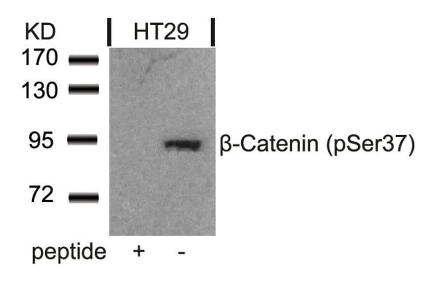 Western blot - b-Catenin (Phospho-Ser37) Antibody from Signalway Antibody (11219) - Antibodies.com