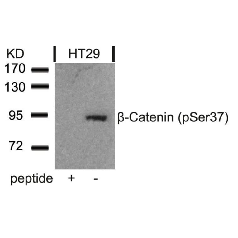 Western blot - b-Catenin (Phospho-Ser37) Antibody from Signalway Antibody (11219) - Antibodies.com