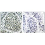 Immunohistochemistry - b-Catenin (Phospho-Ser37) Antibody from Signalway Antibody (11219) - Antibodies.com
