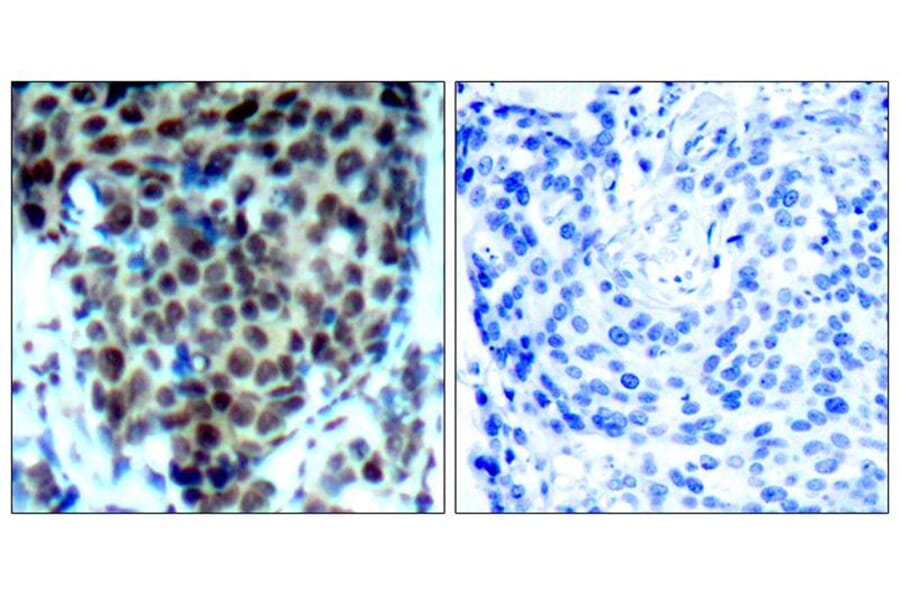 Immunohistochemistry - P38 MAPK (Phospho-Thr180) Antibody from Signalway Antibody (11252) - Antibodies.com