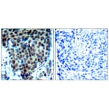 Immunohistochemistry - P38 MAPK (Phospho-Thr180) Antibody from Signalway Antibody (11252) - Antibodies.com