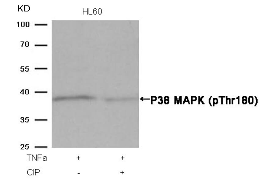 Western blot - P38 MAPK (Phospho-Thr180) Antibody from Signalway Antibody (11252) - Antibodies.com