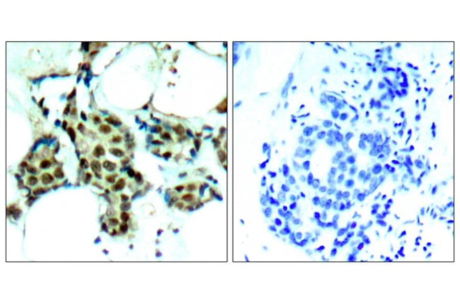 Immunohistochemistry - P38 MAPK (Phospho-Tyr182) Antibody from Signalway Antibody (11253) - Antibodies.com
