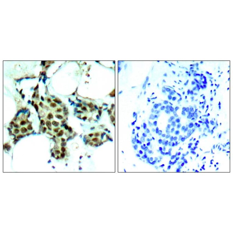 Immunohistochemistry - P38 MAPK (Phospho-Tyr182) Antibody from Signalway Antibody (11253) - Antibodies.com