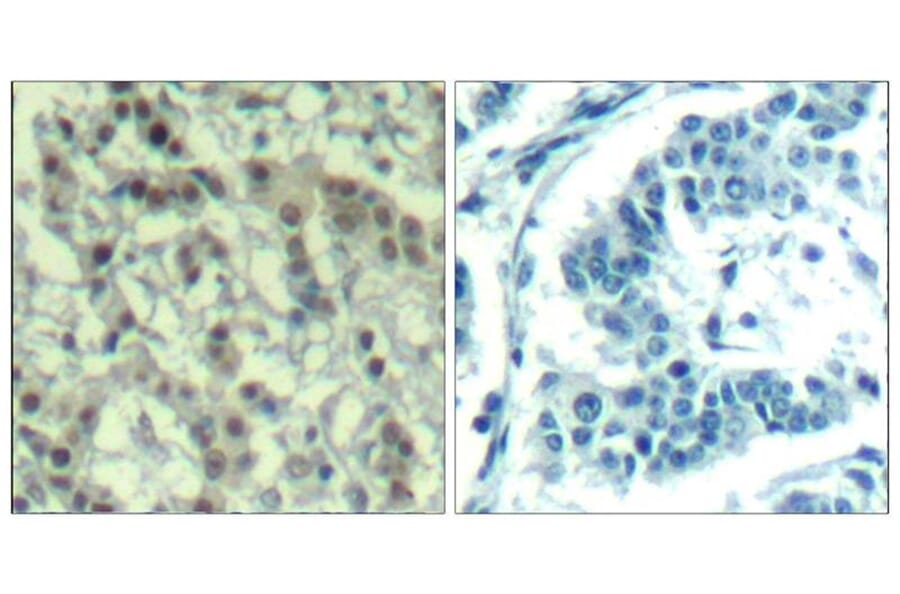Immunohistochemistry - Aurora A (phospho-Thr288) Antibody from Signalway Antibody (11519) - Antibodies.com