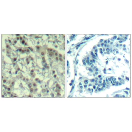 Immunohistochemistry - Aurora A (phospho-Thr288) Antibody from Signalway Antibody (11519) - Antibodies.com