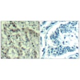 Immunohistochemistry - Aurora A (phospho-Thr288) Antibody from Signalway Antibody (11519) - Antibodies.com