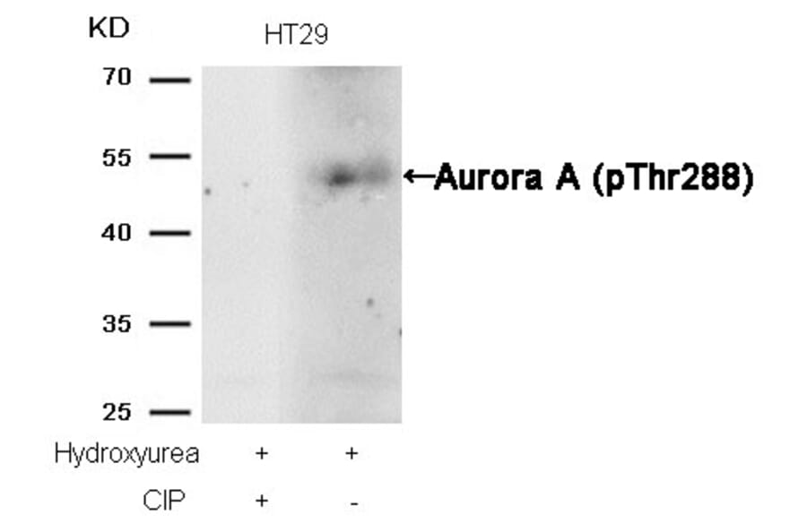 Western blot - Aurora A (phospho-Thr288) Antibody from Signalway Antibody (11519) - Antibodies.com