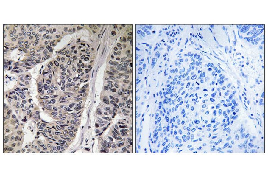 Immunohistochemistry - p130 Cas (Phospho-Tyr410) Antibody from Signalway Antibody (11651) - Antibodies.com