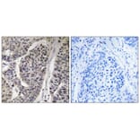 Immunohistochemistry - p130 Cas (Phospho-Tyr410) Antibody from Signalway Antibody (11651) - Antibodies.com