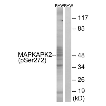 Western blot - MAPKAPK2 (Phospho-Ser272) Antibody from Signalway Antibody (11806) - Antibodies.com