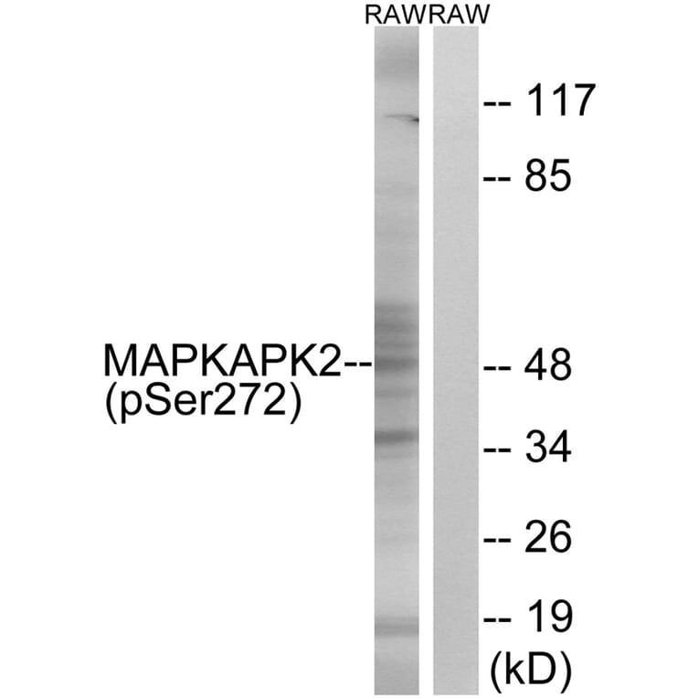 Western blot - MAPKAPK2 (Phospho-Ser272) Antibody from Signalway Antibody (11806) - Antibodies.com