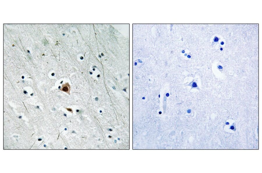 Immunohistochemistry - MAPKAPK2 (Phospho-Ser272) Antibody from Signalway Antibody (11806) - Antibodies.com