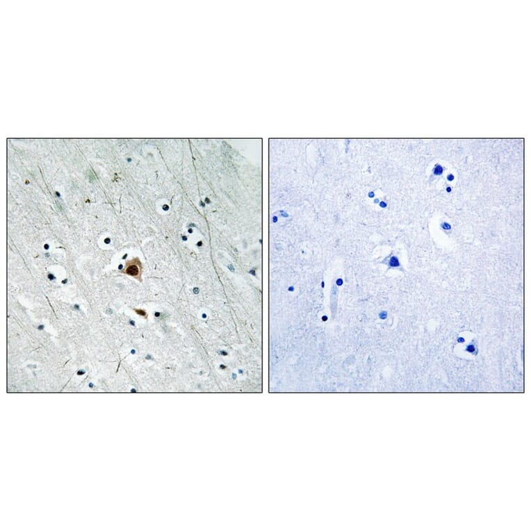 Immunohistochemistry - MAPKAPK2 (Phospho-Ser272) Antibody from Signalway Antibody (11806) - Antibodies.com