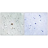 Immunohistochemistry - MAPKAPK2 (Phospho-Ser272) Antibody from Signalway Antibody (11806) - Antibodies.com