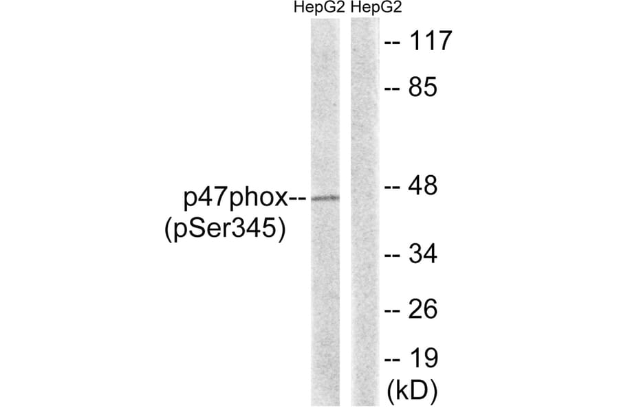 Western blot - p47 phox (Phospho-Ser345) Antibody from Signalway Antibody (11811) - Antibodies.com
