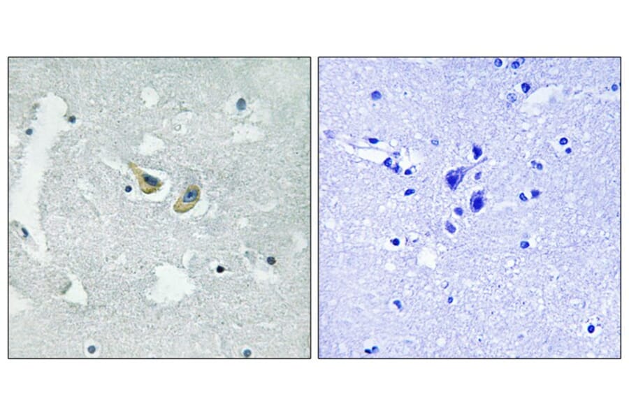 Immunohistochemistry - p47 phox (Phospho-Ser345) Antibody from Signalway Antibody (11811) - Antibodies.com