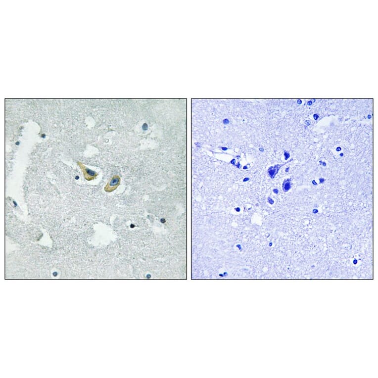 Immunohistochemistry - p47 phox (Phospho-Ser345) Antibody from Signalway Antibody (11811) - Antibodies.com