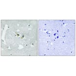 Immunohistochemistry - p47 phox (Phospho-Ser345) Antibody from Signalway Antibody (11811) - Antibodies.com