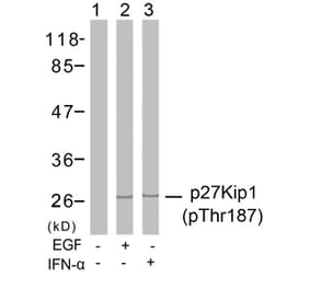Western blot - p27Kip1 (Phospho-Thr187) Antibody from Signalway Antibody (11208) - Antibodies.com