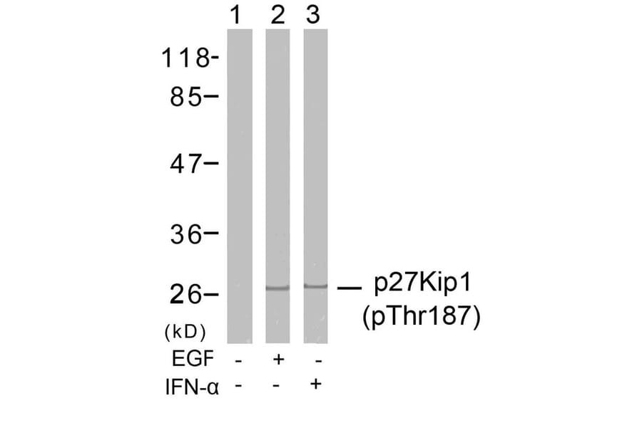 Western blot - p27Kip1 (Phospho-Thr187) Antibody from Signalway Antibody (11208) - Antibodies.com