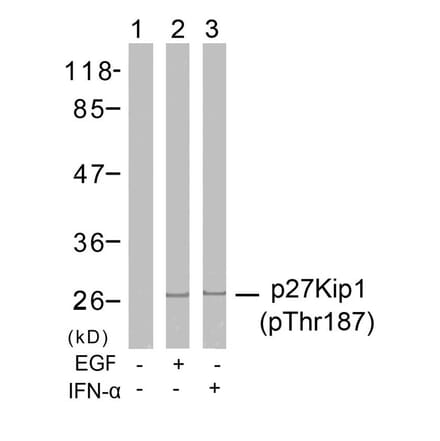 Western blot - p27Kip1 (Phospho-Thr187) Antibody from Signalway Antibody (11208) - Antibodies.com