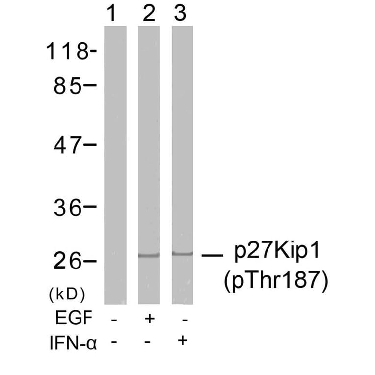 Western blot - p27Kip1 (Phospho-Thr187) Antibody from Signalway Antibody (11208) - Antibodies.com