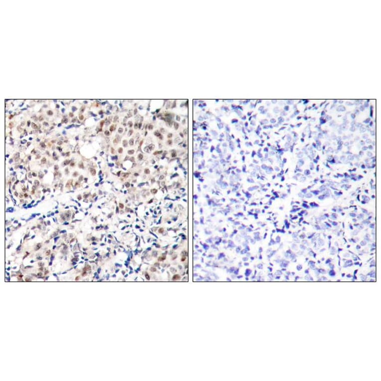 Immunohistochemistry - p27Kip1 (Phospho-Thr187) Antibody from Signalway Antibody (11208) - Antibodies.com