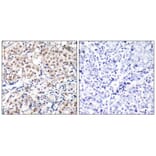 Immunohistochemistry - p27Kip1 (Phospho-Thr187) Antibody from Signalway Antibody (11208) - Antibodies.com