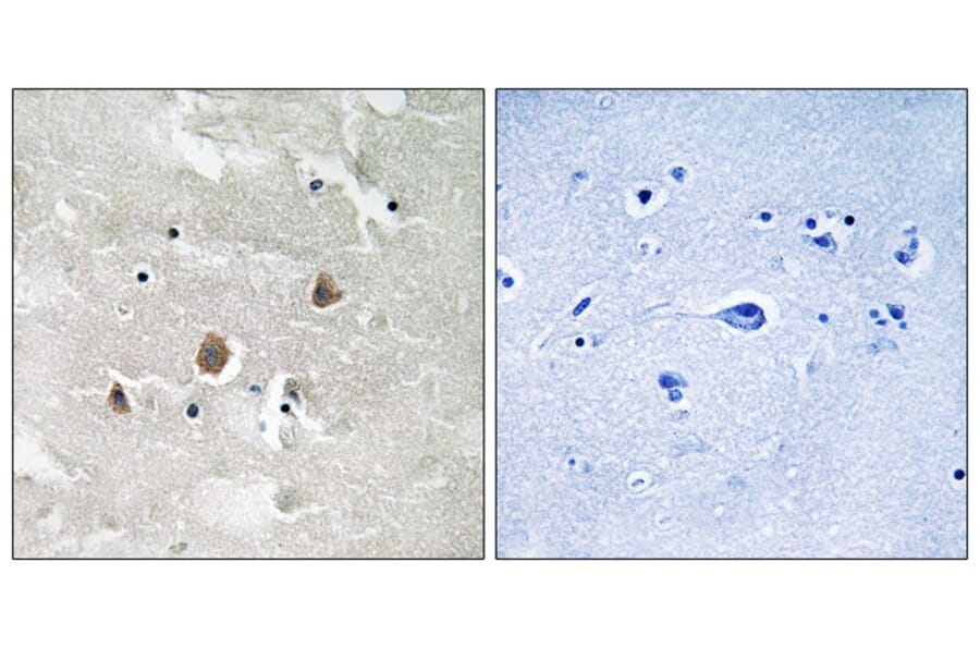 Immunohistochemistry - MAP3K1 (Phospho-Thr1402) Antibody from Signalway Antibody (11737) - Antibodies.com
