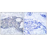Immunohistochemistry - Zap-70 (Phospho-Tyr493) Antibody from Signalway Antibody (11160) - Antibodies.com
