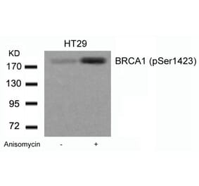 Western blot - BRCA1 (Phospho-Ser1423) Antibody from Signalway Antibody (11242) - Antibodies.com