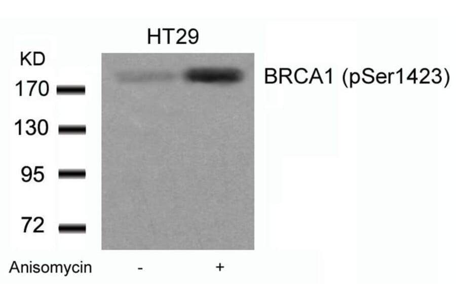 Western blot - BRCA1 (Phospho-Ser1423) Antibody from Signalway Antibody (11242) - Antibodies.com