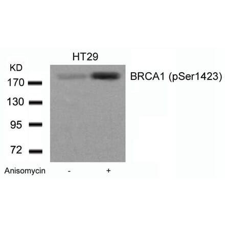 Western blot - BRCA1 (Phospho-Ser1423) Antibody from Signalway Antibody (11242) - Antibodies.com