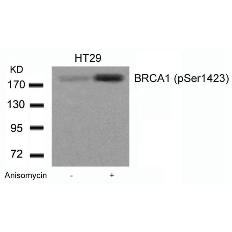 Western blot - BRCA1 (Phospho-Ser1423) Antibody from Signalway Antibody (11242) - Antibodies.com