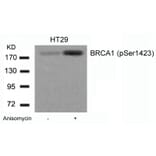 Western blot - BRCA1 (Phospho-Ser1423) Antibody from Signalway Antibody (11242) - Antibodies.com
