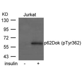 Western blot - p62Dok (phospho-Tyr362) Antibody from Signalway Antibody (11276) - Antibodies.com