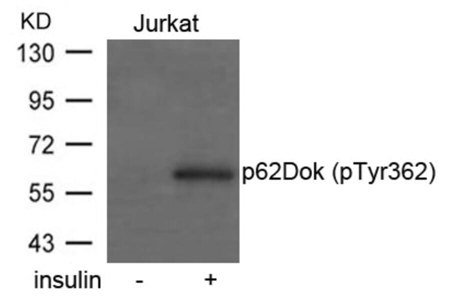 Western blot - p62Dok (phospho-Tyr362) Antibody from Signalway Antibody (11276) - Antibodies.com